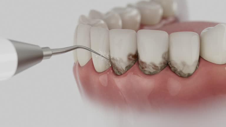 Trusted Emergency Dentist service in Cassopolis, MI - Dentist Open Now